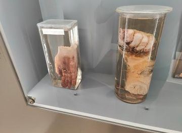 austria/eisenstadt/attraction/narrenturm-pathologisch-anatomische-sammlung