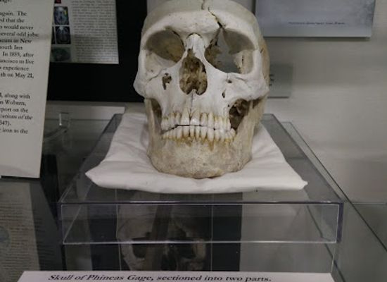 massachusetts/south-shore/attraction/warren-anatomical-museum