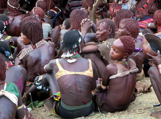 File:Scars from Whipping (11725034555).jpg - Wikimedia Commons