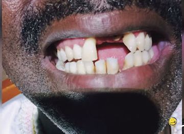 comoros/mutsamudu/landmark/chiwe-mutsamudu