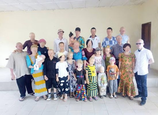 sierra-leone/western-area/landmark/sierra-leone-albinism-foundation